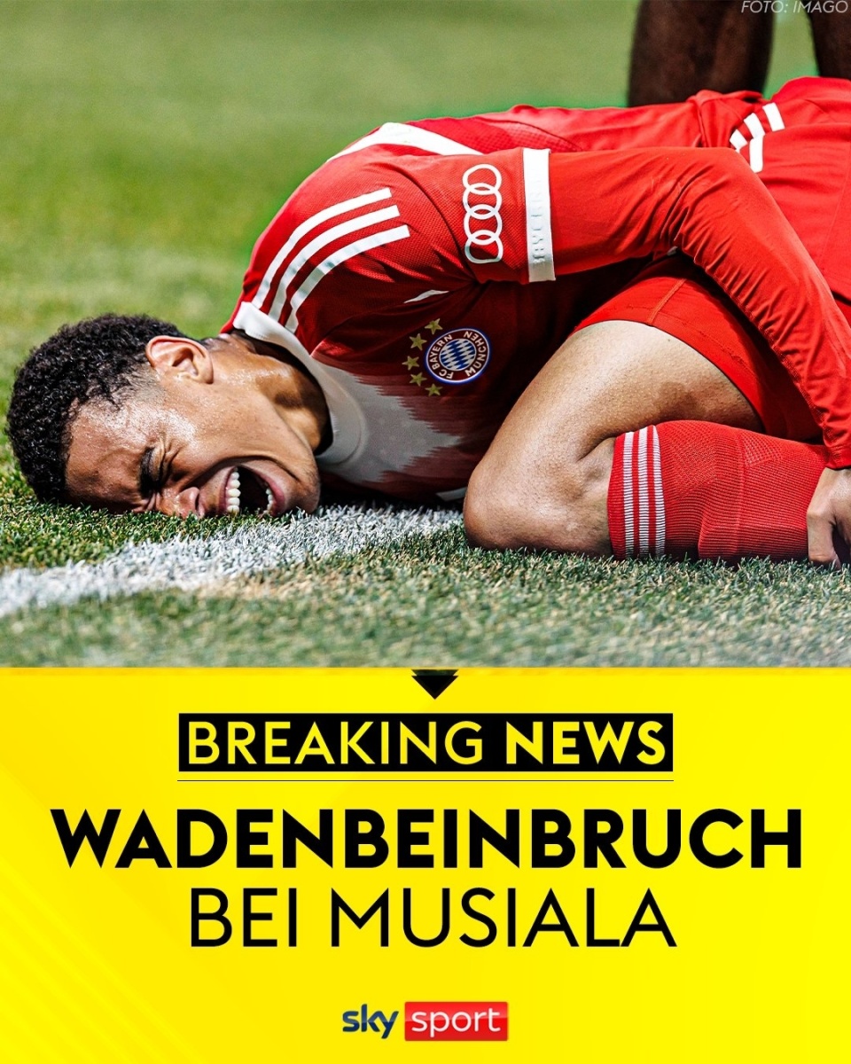 开云体育-穆尔西亚队员集体受伤,阵容将面临严重考验